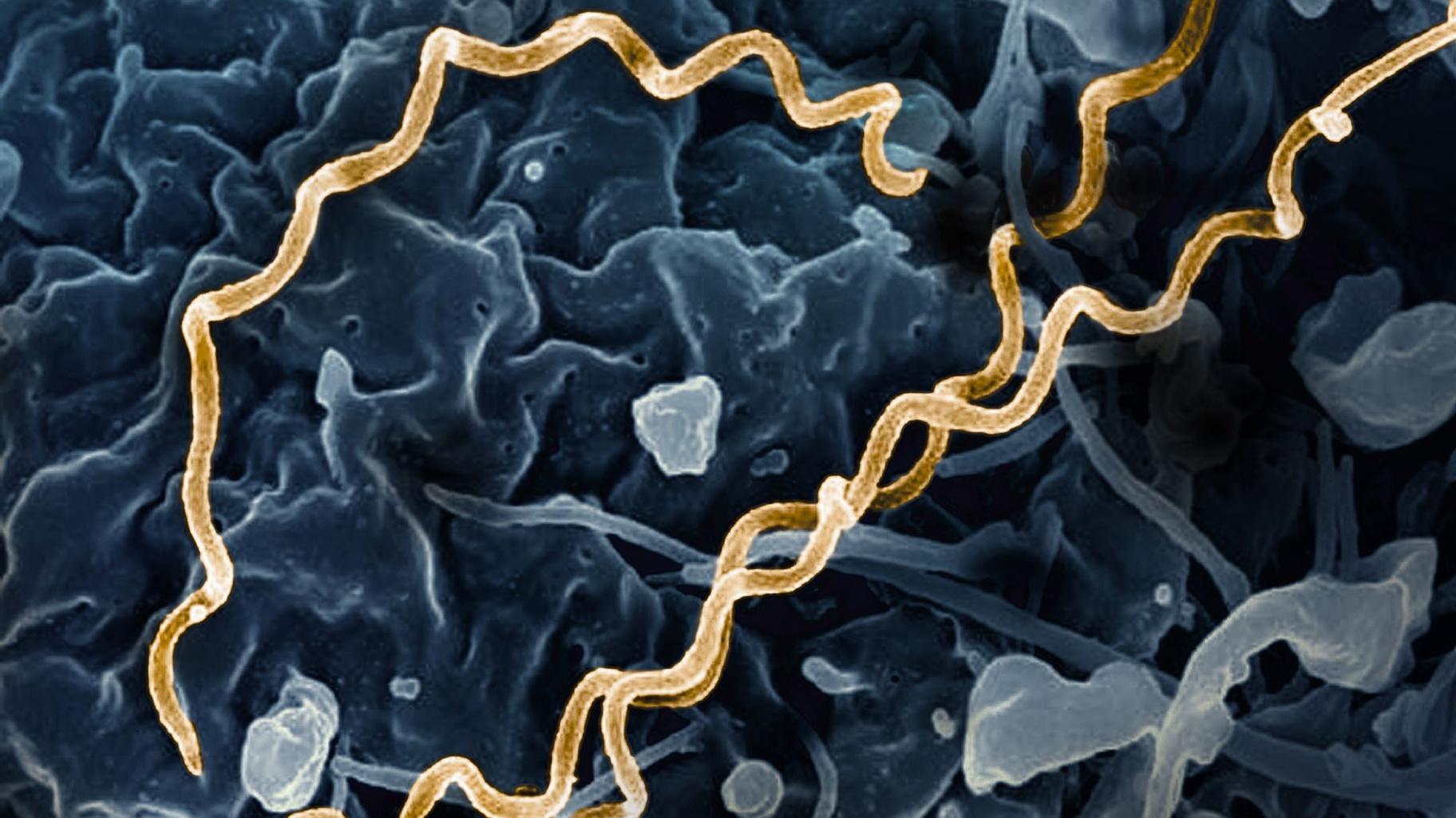 Syphilis is caused by the bacteria Treponema pallidum. Cases have been increasing in the United States. (NIAID via CNN Newsource)