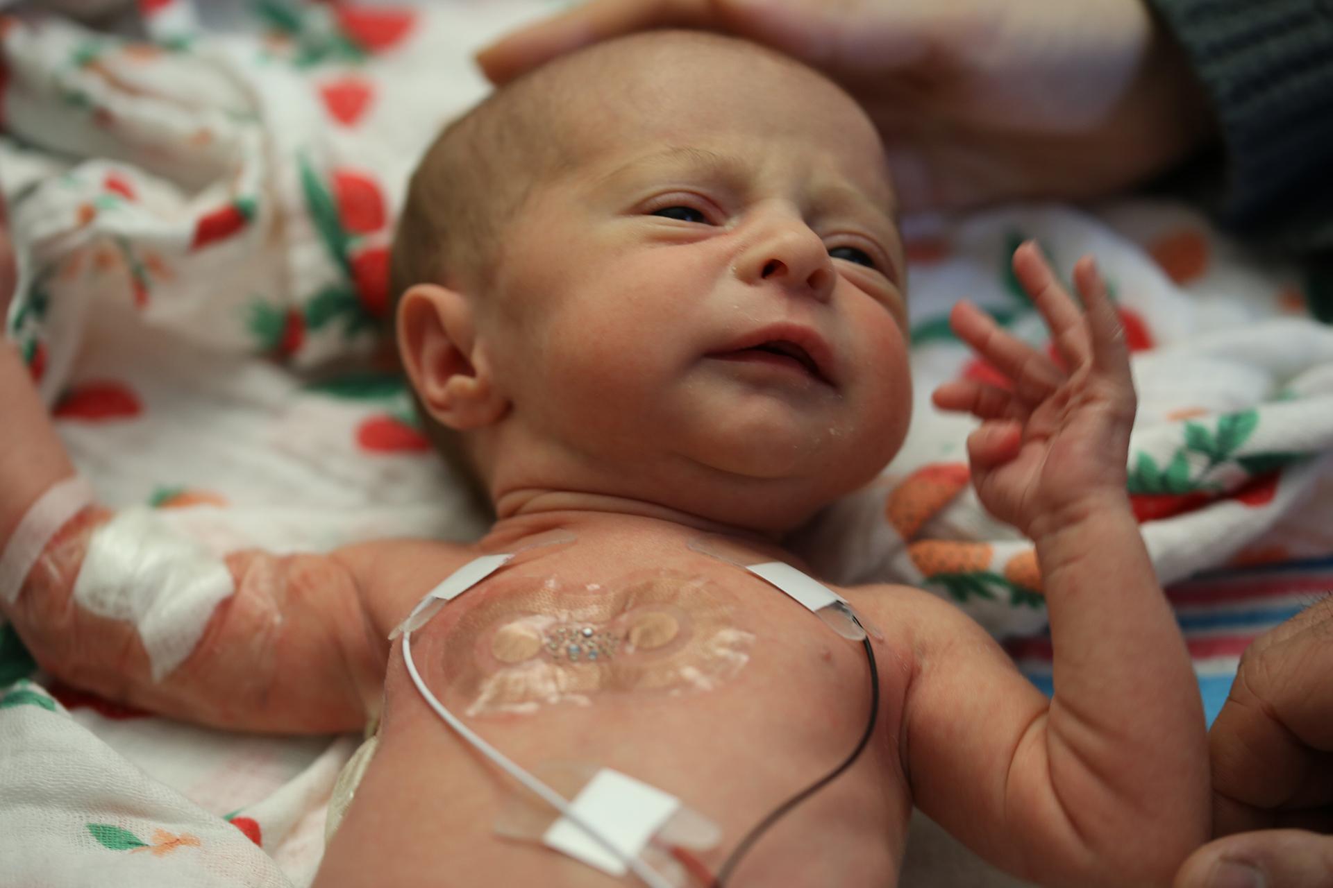 A chest sensor, measuring 5 centimeters by 2.5 centimeters, as seen on an infant in the neonatal intensive care unit. (Courtesy of Northwestern University)