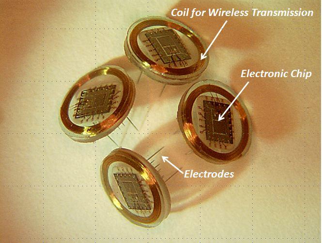 Wireless floating microelectrode arrays (WFMAs) will be implanted in the visual cortex of the brain, where they will receive and transmit visual information to the brain (Courtesy of Philip Troyk and Vernon L. Towle)
